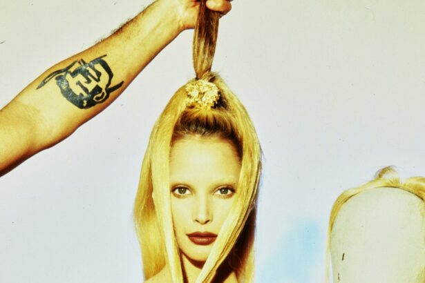 What Is Hairline-Lowering Surgery? Experts Explain