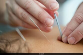 Chinese Man Hospitalised With Collapsed Lungs After Acupuncture Session