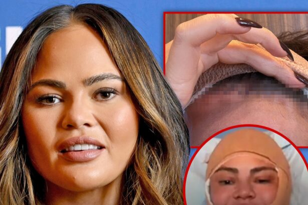 Chrissy Teigen Addresses Bandaged Face After Surgery