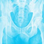 Don’t wait until menopause to strengthen your bones 