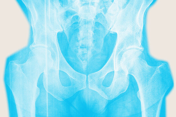 Don’t wait until menopause to strengthen your bones 