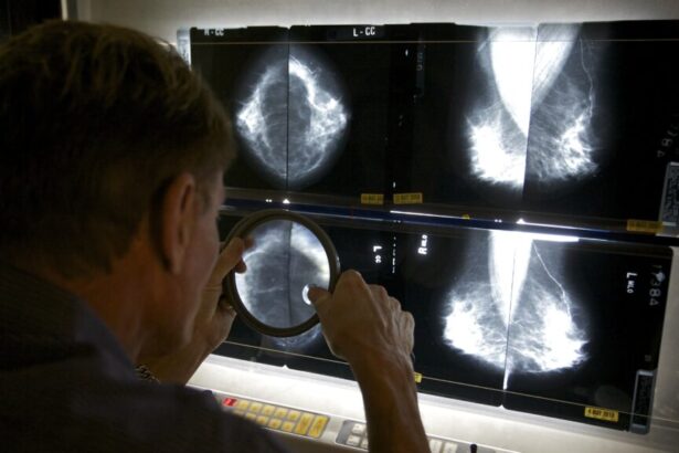  Early-onset cancer: the types that are on the rise