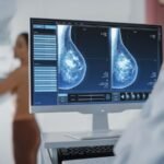 Extra cancer screening could help pick up early cases in dense breasts