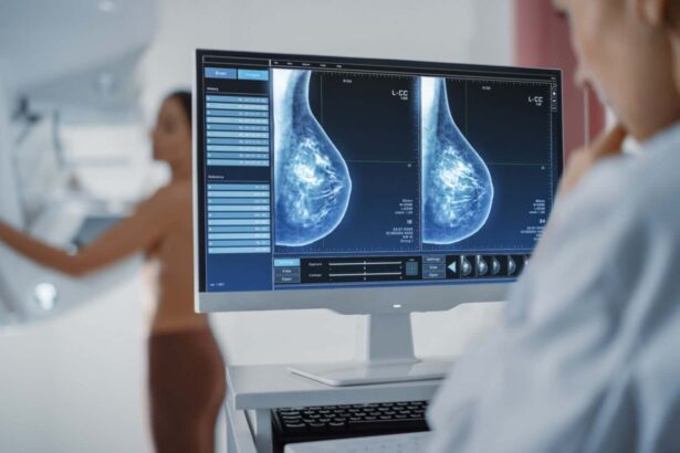 Extra cancer screening could help pick up early cases in dense breasts