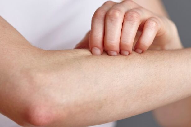 Fungi on Your Skin Could Produce a Potent Antibiotic to Fight Infections : ScienceAlert