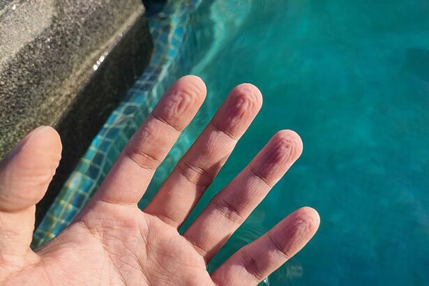 Got pruney fingers? Here’s the scientific skinny to explain it