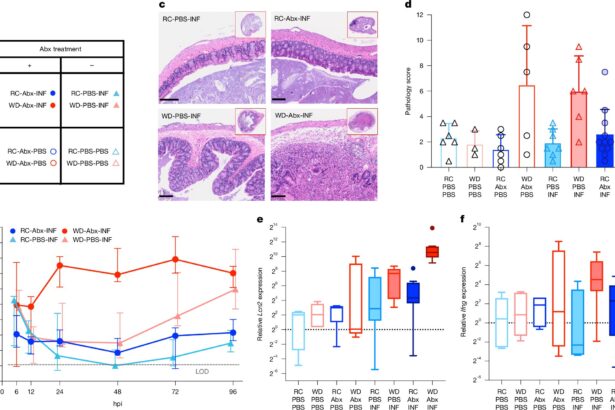 How diet shapes gut microbiome health