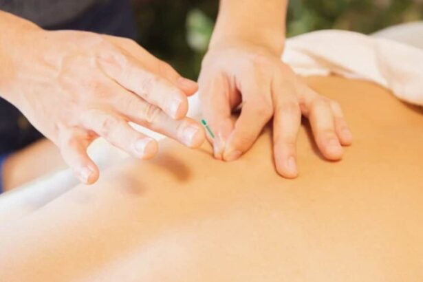 Illegal Acupuncture In Cybercafe Leaves Chinese Man In ICU With Punctured Lungs