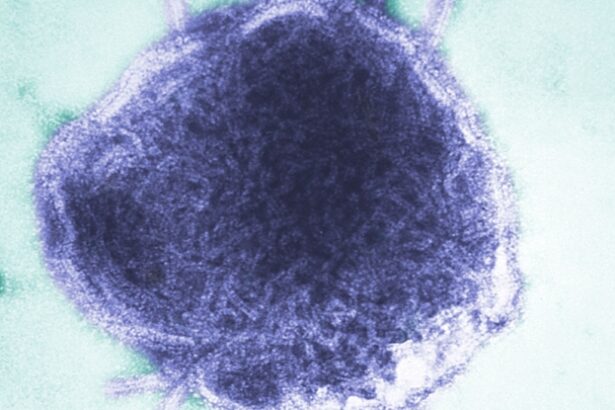 Measles Could Become Endemic in US if Surge Continues, Expert Warns : ScienceAlert