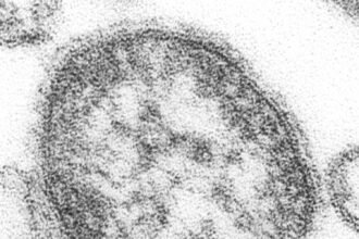 Measles virus detected in Houston wastewater before cases were reported