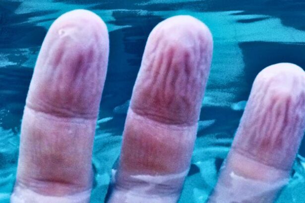Mystery About The Way Fingers Wrinkle in Water Might Have an Answer : ScienceAlert
