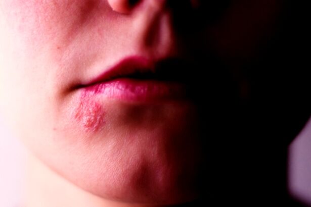 New Link Connects Herpes to Alzheimer’s. Here’s What We Know. : ScienceAlert