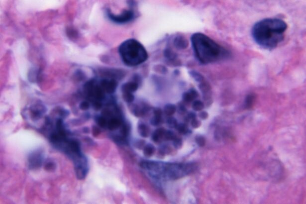 Parasite Infecting Up to 50% of People Can Decapitate Human Sperm : ScienceAlert