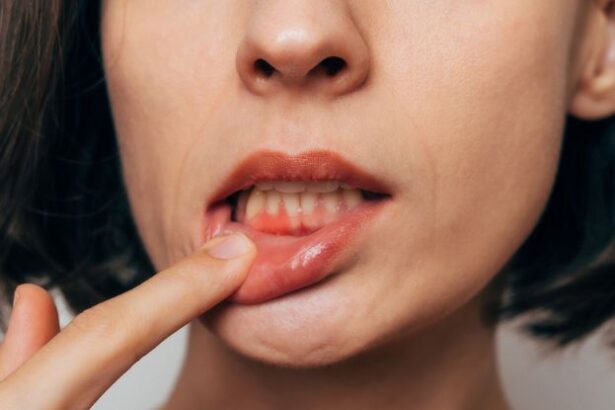Poor Oral Hygiene Could Be Taking a Toll on Your Heart, Expert Says : ScienceAlert