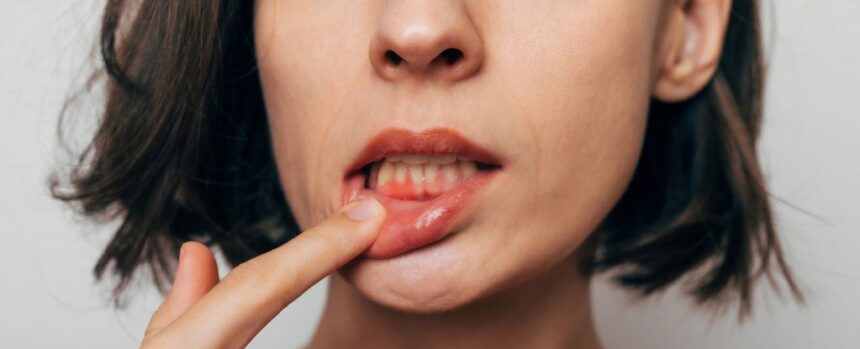 Poor Oral Hygiene Could Be Taking a Toll on Your Heart, Expert Says : ScienceAlert