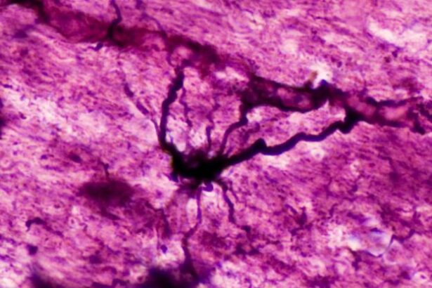 Psychedelics May ‘Reset’ Brain Cells in Mood And Immune Disorders : ScienceAlert