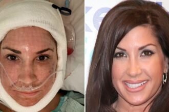 ‘Real Housewives’ Star, 55, Posts Shocking Post-Op Video After Facelift