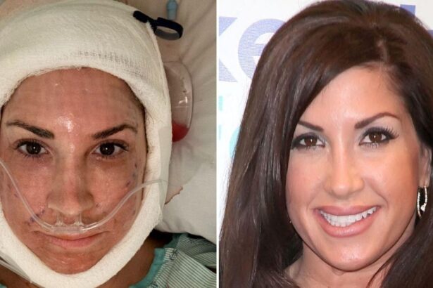 ‘Real Housewives’ Star, 55, Posts Shocking Post-Op Video After Facelift