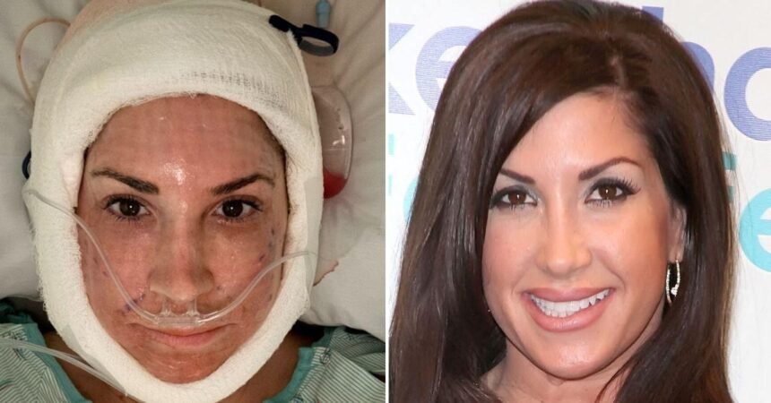 ‘Real Housewives’ Star, 55, Posts Shocking Post-Op Video After Facelift