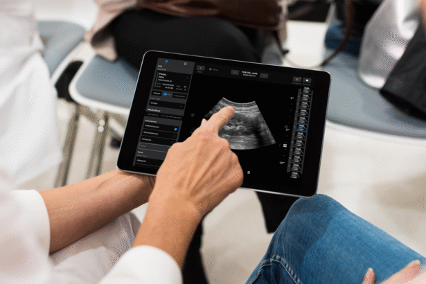 Samsung may invest in 0M round for medical imaging startup Exo