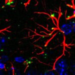 Scientists Discover Molecule That Blocks Aging And Dementia in Mice : ScienceAlert