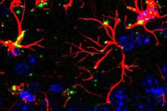 Scientists Discover Molecule That Blocks Aging And Dementia in Mice : ScienceAlert