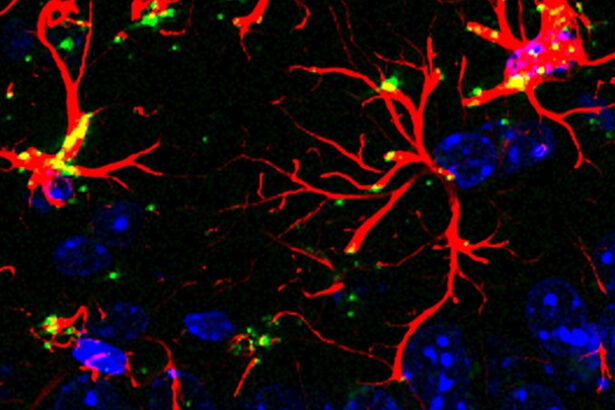 Scientists Discover Molecule That Blocks Aging And Dementia in Mice : ScienceAlert