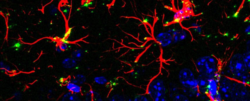 Scientists Discover Molecule That Blocks Aging And Dementia in Mice : ScienceAlert