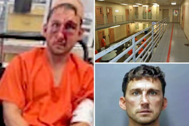 Serial Tesla road-rager Nathaniel Radimak beaten to a bloody pulp in prison after he’s arrested for attacking mom, teen learning how to park