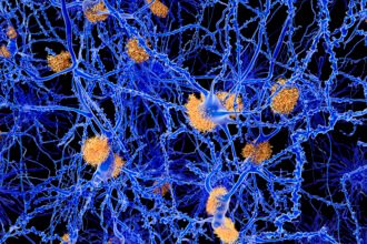 Sugar-Coated Particles May Protect Neurons From Alzheimer’s Disease : ScienceAlert