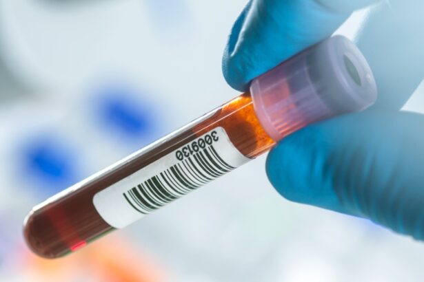 The US Just Approved The First Blood Test For Alzheimer’s Disease : ScienceAlert