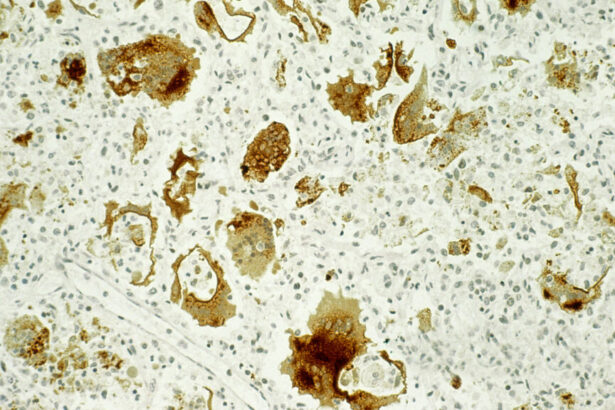 The pain of even ‘mild’ cases of measles, pertussis, and more