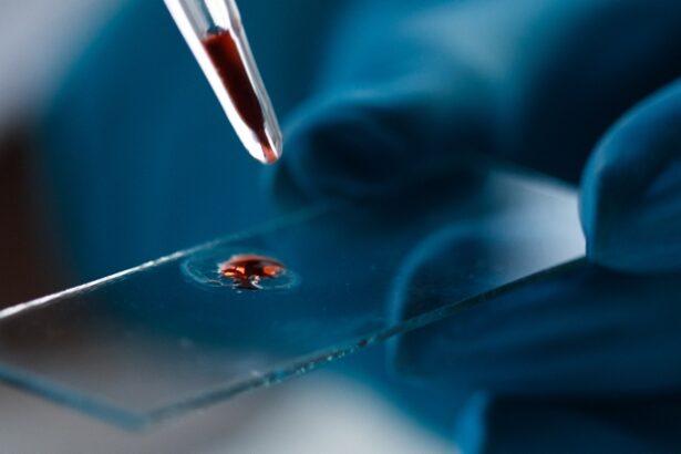 This Blood Signal Could Warn You of Alzheimer’s 10 Years Before Symptoms : ScienceAlert