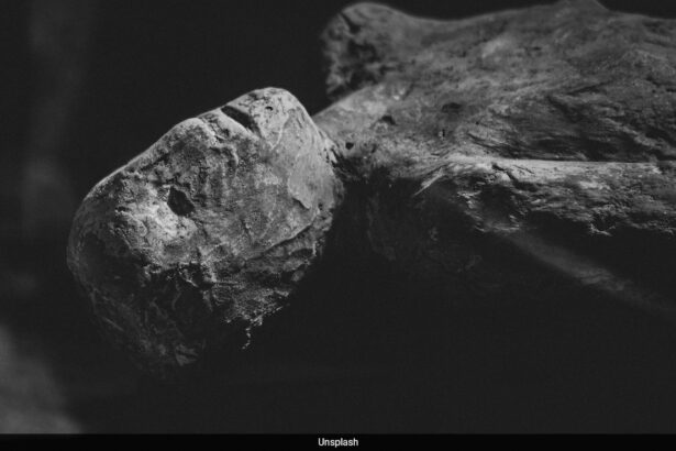 US Woman Under Investigation After Mummified Remains Of 600-Pound Son Found In Home