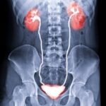 World’s First Bladder Transplant Gives Cancer Patient New Hope : ScienceAlert