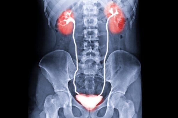 World’s First Bladder Transplant Gives Cancer Patient New Hope : ScienceAlert