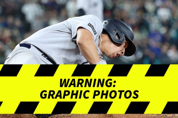 Yankees’ Oswaldo Cabrera Suffers Gruesome Injury, Taken Off Field In Ambulance