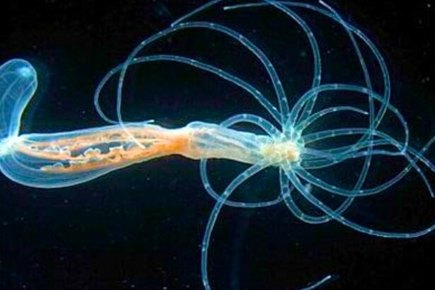 Ancient Blueprint For Human Bodies Discovered in Sea Anemones : ScienceAlert