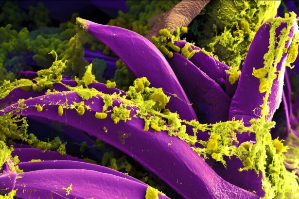 Black Death Plague Bacterium Became Less Fatal thanks to Just One Genetic Tweak