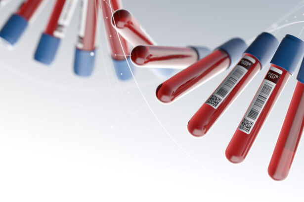 Cancer blood tests offer hope, but more data needed on ctDNA tests