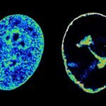 Cold sore virus immediately reshapes our genome to boost its growth