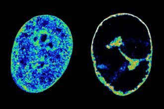 Cold sore virus immediately reshapes our genome to boost its growth