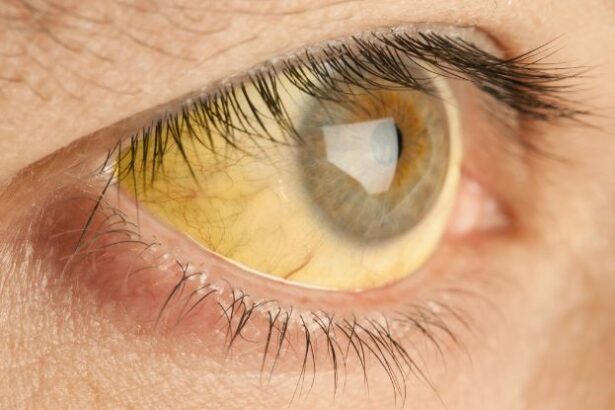 Compound That Turns People Yellow Could Protect Against Malaria : ScienceAlert