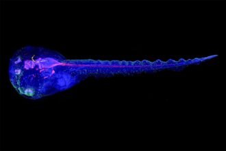 Cyborg tadpoles are helping us learn how brain development starts