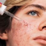 Does Retinol Reverse Signs of Aging? Here’s The Science. : ScienceAlert