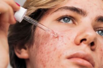 Does Retinol Reverse Signs of Aging? Here’s The Science. : ScienceAlert