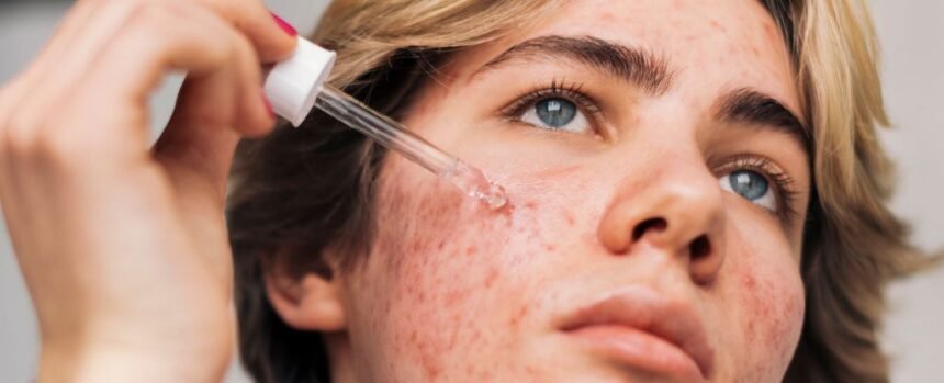 Does Retinol Reverse Signs of Aging? Here’s The Science. : ScienceAlert