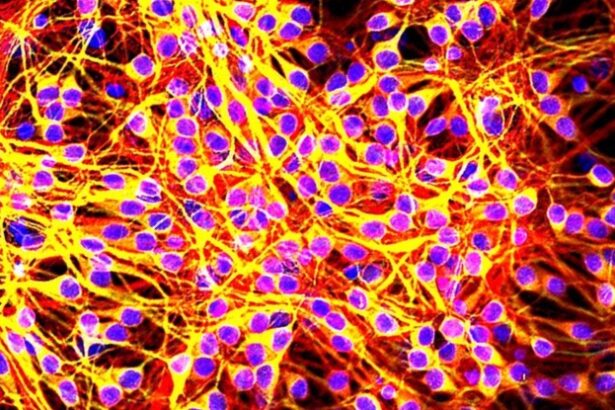 FDA-Approved Sleeping Pill Slows Alzheimer’s Tangles in Pre-Clinical Trial : ScienceAlert