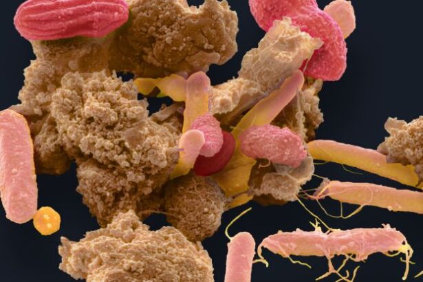 Fecal Transplants Present a Concerning Risk For Some, Study Finds : ScienceAlert