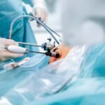 Gastric bypass surgery may cut the risk of bowel cancer